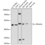 Western Blot - Anti-PPHLN1/Periphilin-1 Antibody (A306477) - Antibodies.com