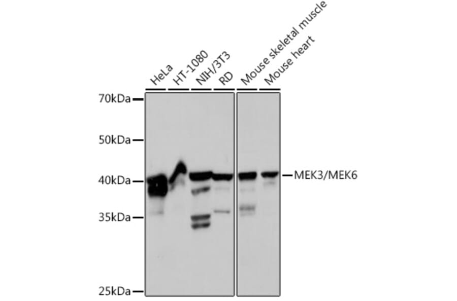 Western Blot - Anti-MEK3 + MMK6 Antibody [ARC2356] (A306478) - Antibodies.com