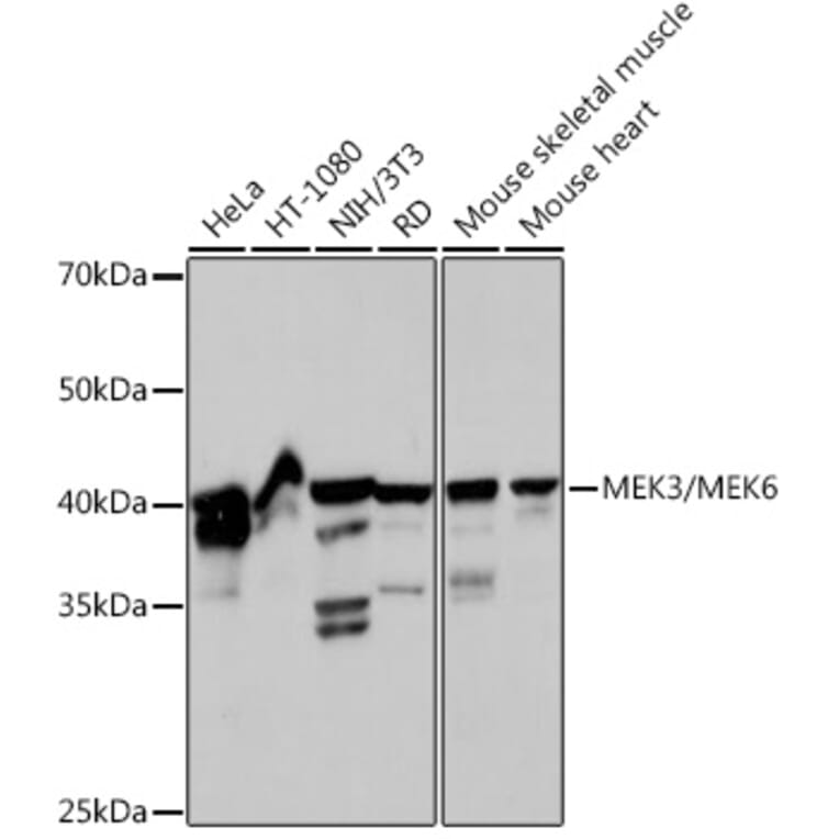 Western Blot - Anti-MEK3 + MMK6 Antibody [ARC2356] (A306478) - Antibodies.com