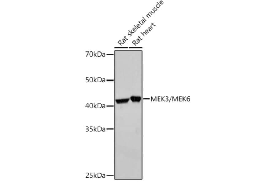 Western Blot - Anti-MEK3 + MMK6 Antibody [ARC2356] (A306478) - Antibodies.com