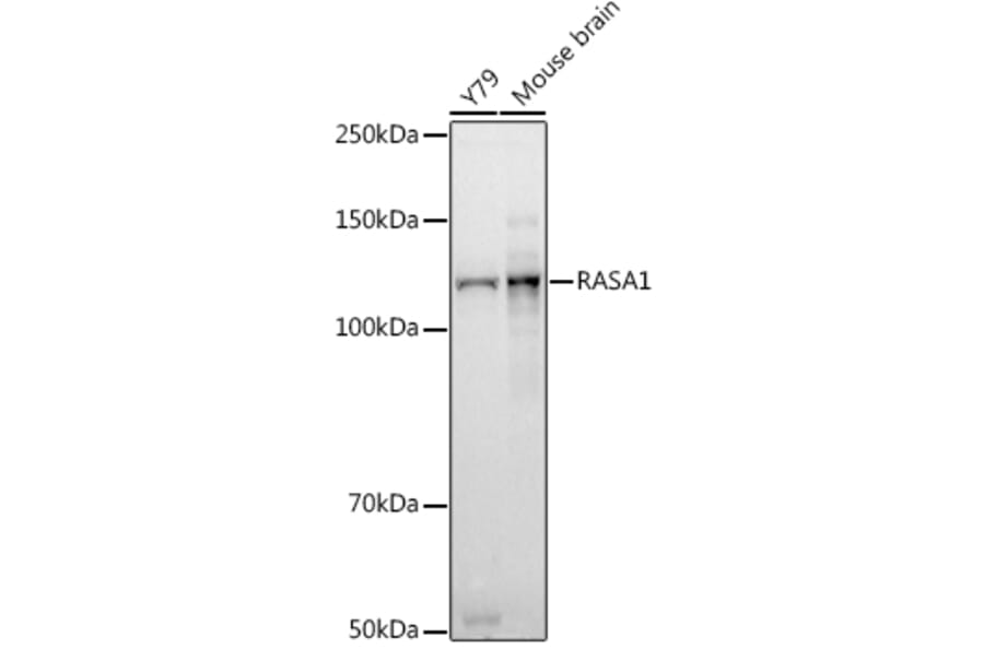 Western Blot - Anti-RASA1 Antibody [ARC2730] (A306479) - Antibodies.com