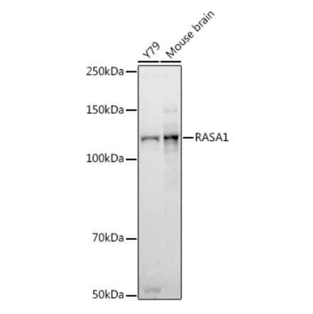 Western Blot - Anti-RASA1 Antibody [ARC2730] (A306479) - Antibodies.com