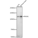 Western Blot - Anti-RASA1 Antibody [ARC2730] (A306479) - Antibodies.com