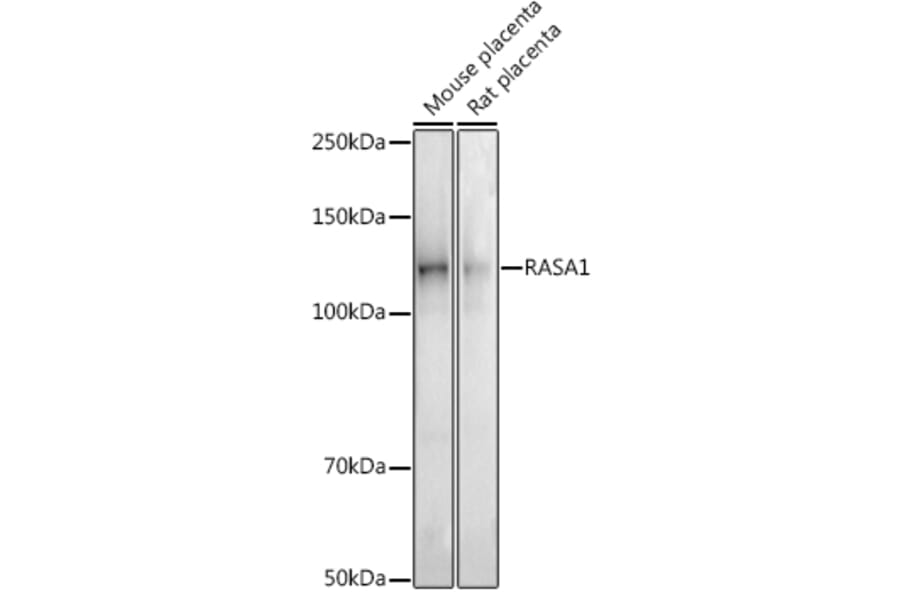Western Blot - Anti-RASA1 Antibody [ARC2730] (A306479) - Antibodies.com