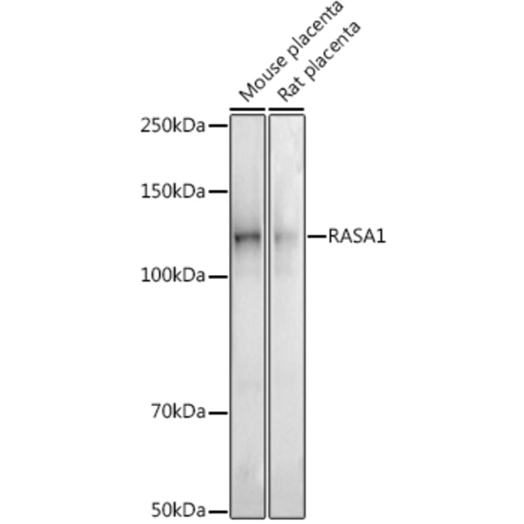 Western Blot - Anti-RASA1 Antibody [ARC2730] (A306479) - Antibodies.com