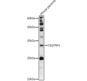 Western Blot - Anti-GIP Antibody (A306480) - Antibodies.com