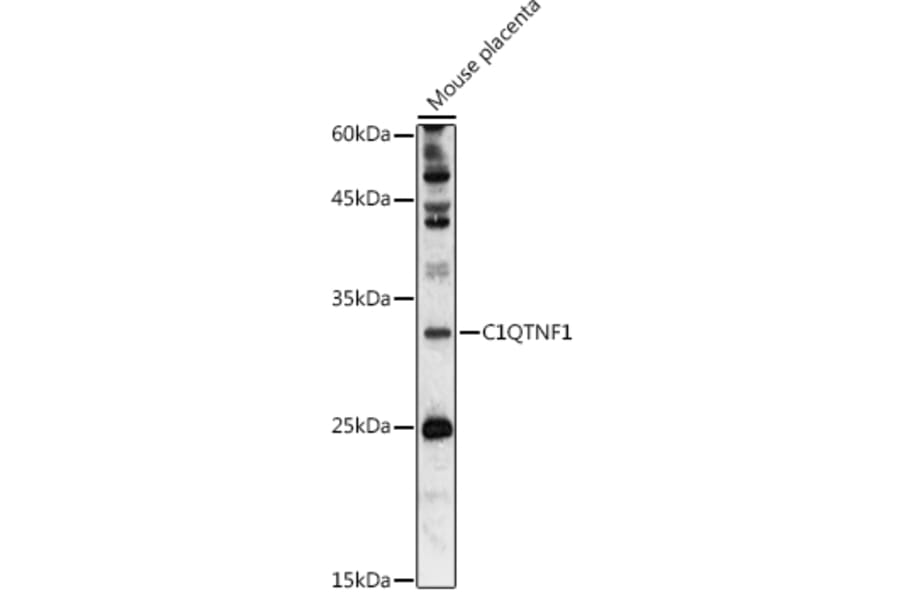 Western Blot - Anti-GIP Antibody (A306480) - Antibodies.com