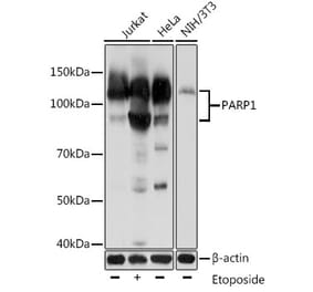 Western Blot - Anti-PARP1 Antibody [AMC0216] (A306481) - Antibodies.com