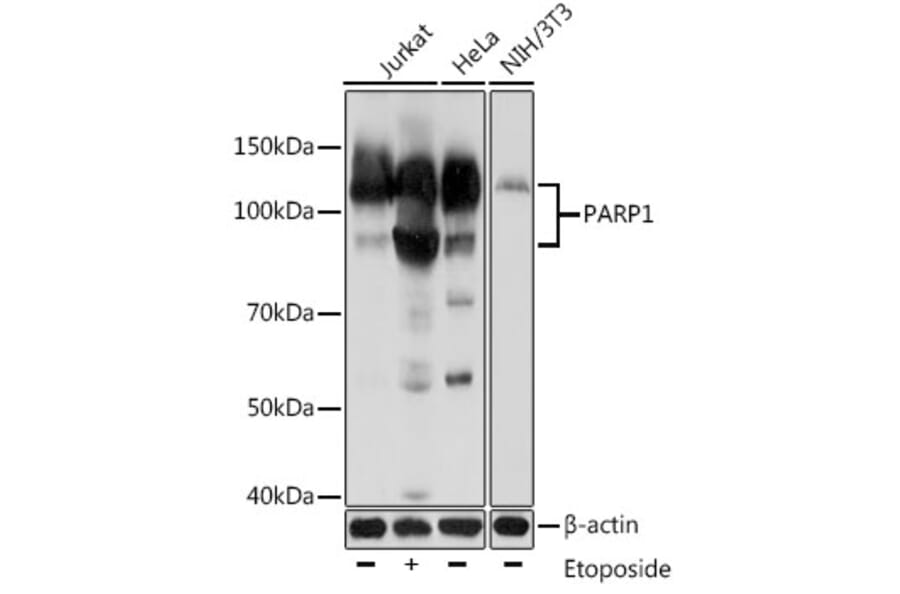 Western Blot - Anti-PARP1 Antibody [AMC0216] (A306481) - Antibodies.com
