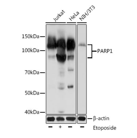 Western Blot - Anti-PARP1 Antibody [AMC0216] (A306481) - Antibodies.com