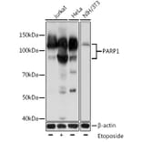 Western Blot - Anti-PARP1 Antibody [AMC0216] (A306481) - Antibodies.com