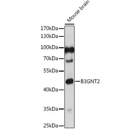 Western Blot - Anti-B3GNT1 Antibody (A306482) - Antibodies.com