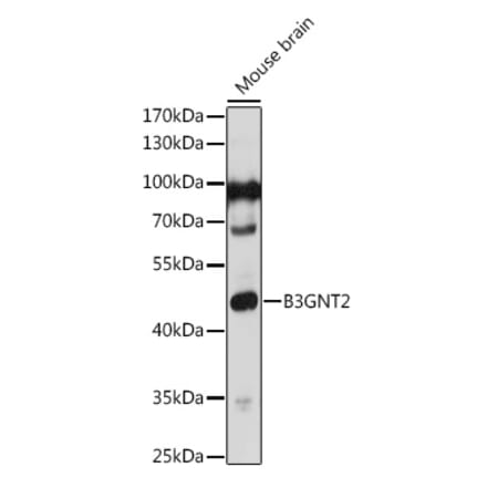 Western Blot - Anti-B3GNT1 Antibody (A306482) - Antibodies.com