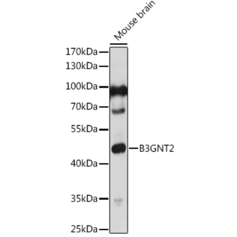 Western Blot - Anti-B3GNT1 Antibody (A306482) - Antibodies.com