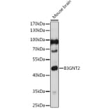 Western Blot - Anti-B3GNT1 Antibody (A306482) - Antibodies.com