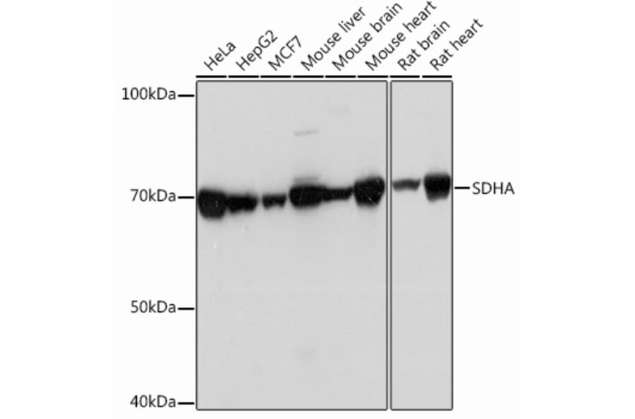 Western Blot - Anti-SDHA Antibody [ARC0726] (A306485) - Antibodies.com