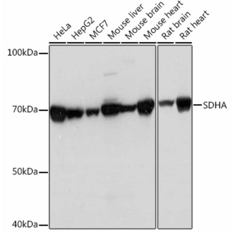 Western Blot - Anti-SDHA Antibody [ARC0726] (A306485) - Antibodies.com