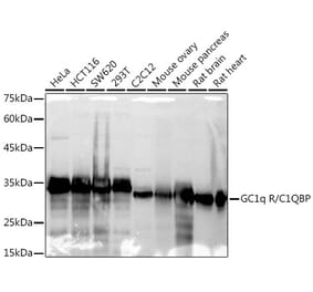 Western Blot - Anti-GC1q R Antibody [ARC2753] (A306487) - Antibodies.com