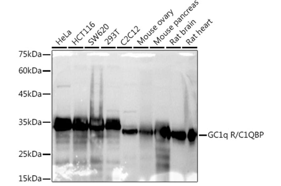 Western Blot - Anti-GC1q R Antibody [ARC2753] (A306487) - Antibodies.com