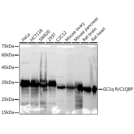 Western Blot - Anti-GC1q R Antibody [ARC2753] (A306487) - Antibodies.com