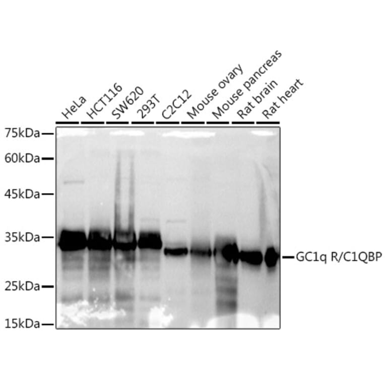 Western Blot - Anti-GC1q R Antibody [ARC2753] (A306487) - Antibodies.com