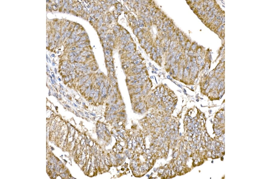 Immunohistochemistry - Anti-GC1q R Antibody [ARC2753] (A306487) - Antibodies.com