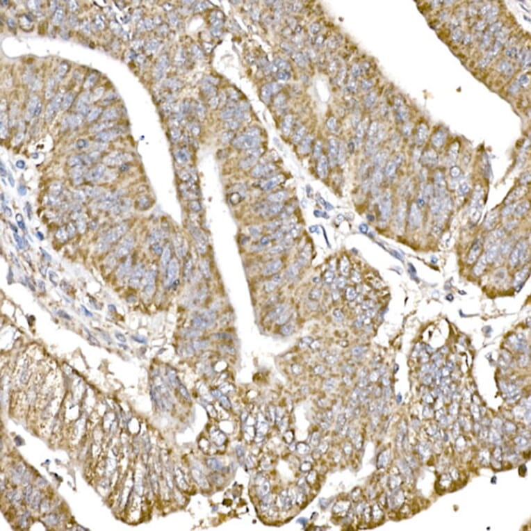 Immunohistochemistry - Anti-GC1q R Antibody [ARC2753] (A306487) - Antibodies.com