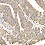Immunohistochemistry - Anti-GC1q R Antibody [ARC2753] (A306487) - Antibodies.com