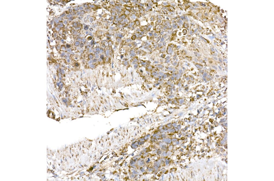 Immunohistochemistry - Anti-GC1q R Antibody [ARC2753] (A306487) - Antibodies.com
