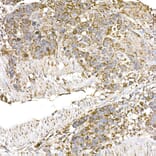 Immunohistochemistry - Anti-GC1q R Antibody [ARC2753] (A306487) - Antibodies.com