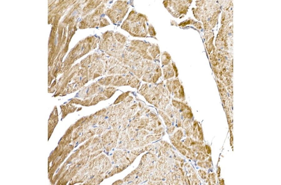 Immunohistochemistry - Anti-GC1q R Antibody [ARC2753] (A306487) - Antibodies.com