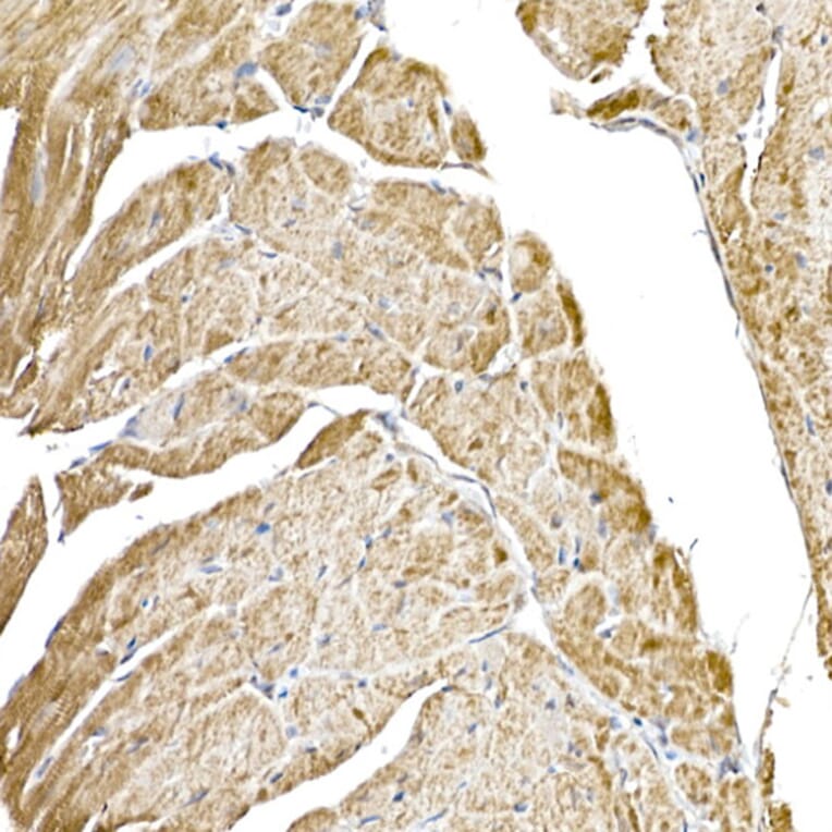 Immunohistochemistry - Anti-GC1q R Antibody [ARC2753] (A306487) - Antibodies.com