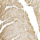 Immunohistochemistry - Anti-GC1q R Antibody [ARC2753] (A306487) - Antibodies.com