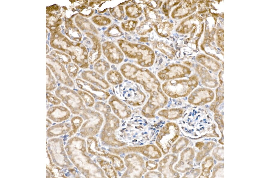 Immunohistochemistry - Anti-GC1q R Antibody [ARC2753] (A306487) - Antibodies.com