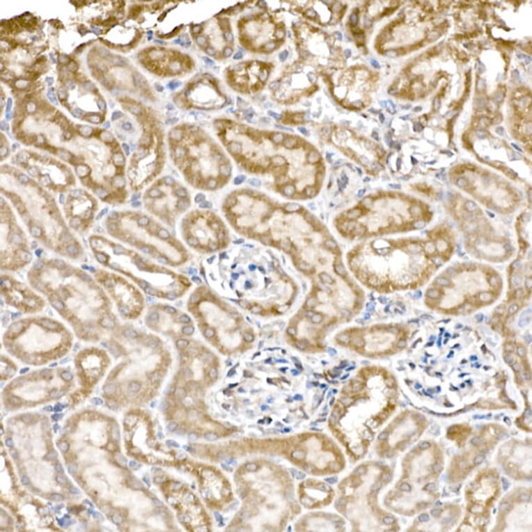 Immunohistochemistry - Anti-GC1q R Antibody [ARC2753] (A306487) - Antibodies.com