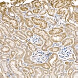 Immunohistochemistry - Anti-GC1q R Antibody [ARC2753] (A306487) - Antibodies.com
