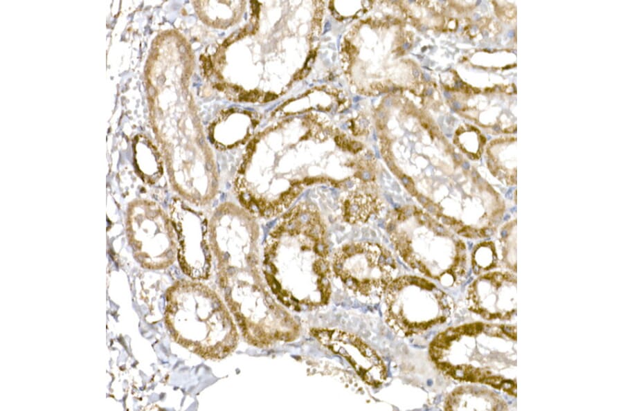 Immunohistochemistry - Anti-GC1q R Antibody [ARC2753] (A306487) - Antibodies.com