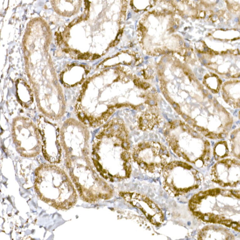 Immunohistochemistry - Anti-GC1q R Antibody [ARC2753] (A306487) - Antibodies.com