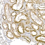 Immunohistochemistry - Anti-GC1q R Antibody [ARC2753] (A306487) - Antibodies.com