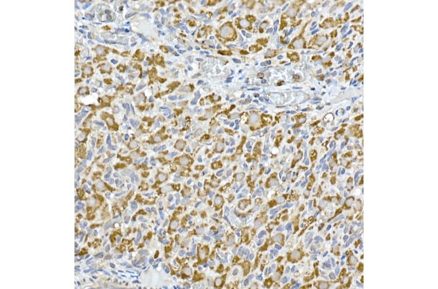Immunohistochemistry - Anti-GC1q R Antibody [ARC2753] (A306487) - Antibodies.com