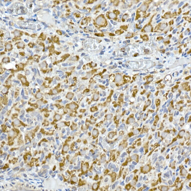 Immunohistochemistry - Anti-GC1q R Antibody [ARC2753] (A306487) - Antibodies.com