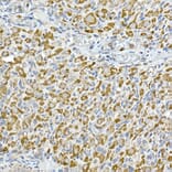 Immunohistochemistry - Anti-GC1q R Antibody [ARC2753] (A306487) - Antibodies.com