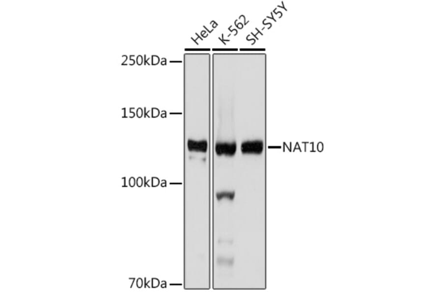 Western Blot - Anti-NAT10 Antibody [ARC2468] (A306488) - Antibodies.com