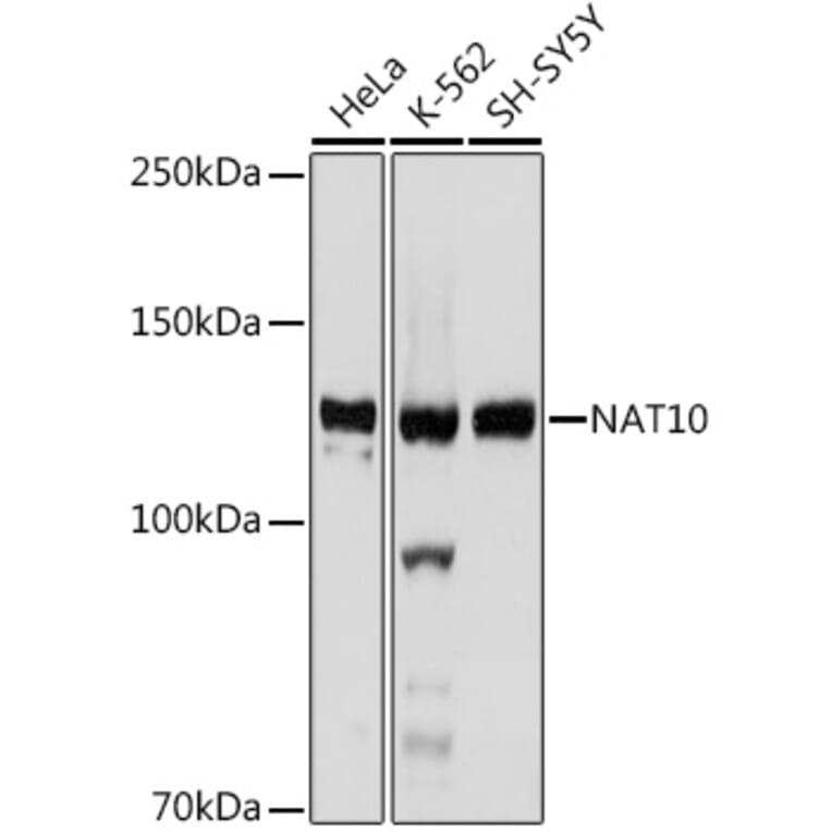 Western Blot - Anti-NAT10 Antibody [ARC2468] (A306488) - Antibodies.com