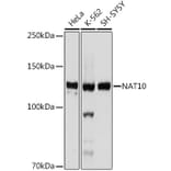 Western Blot - Anti-NAT10 Antibody [ARC2468] (A306488) - Antibodies.com