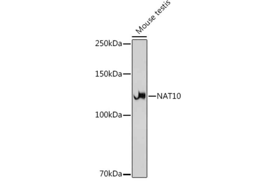 Western Blot - Anti-NAT10 Antibody [ARC2468] (A306488) - Antibodies.com