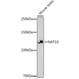 Western Blot - Anti-NAT10 Antibody [ARC2468] (A306488) - Antibodies.com