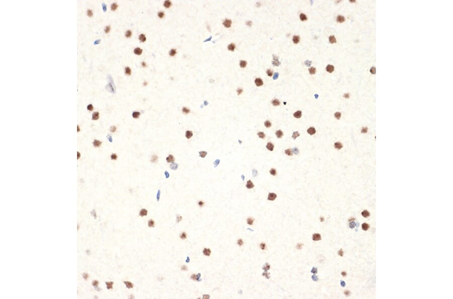 Immunohistochemistry - Anti-NAT10 Antibody [ARC2468] (A306488) - Antibodies.com