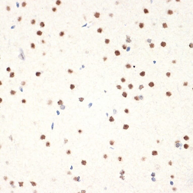 Immunohistochemistry - Anti-NAT10 Antibody [ARC2468] (A306488) - Antibodies.com