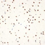 Immunohistochemistry - Anti-NAT10 Antibody [ARC2468] (A306488) - Antibodies.com